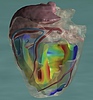 SGI a simulace největšího modelu srdce na světě